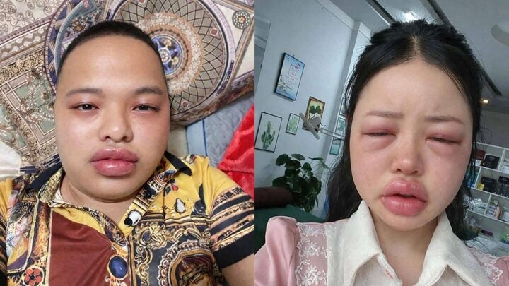 gioi tre phat cuong mon banh trung kien nhung khong phai ai cung nen an hinh anh 4