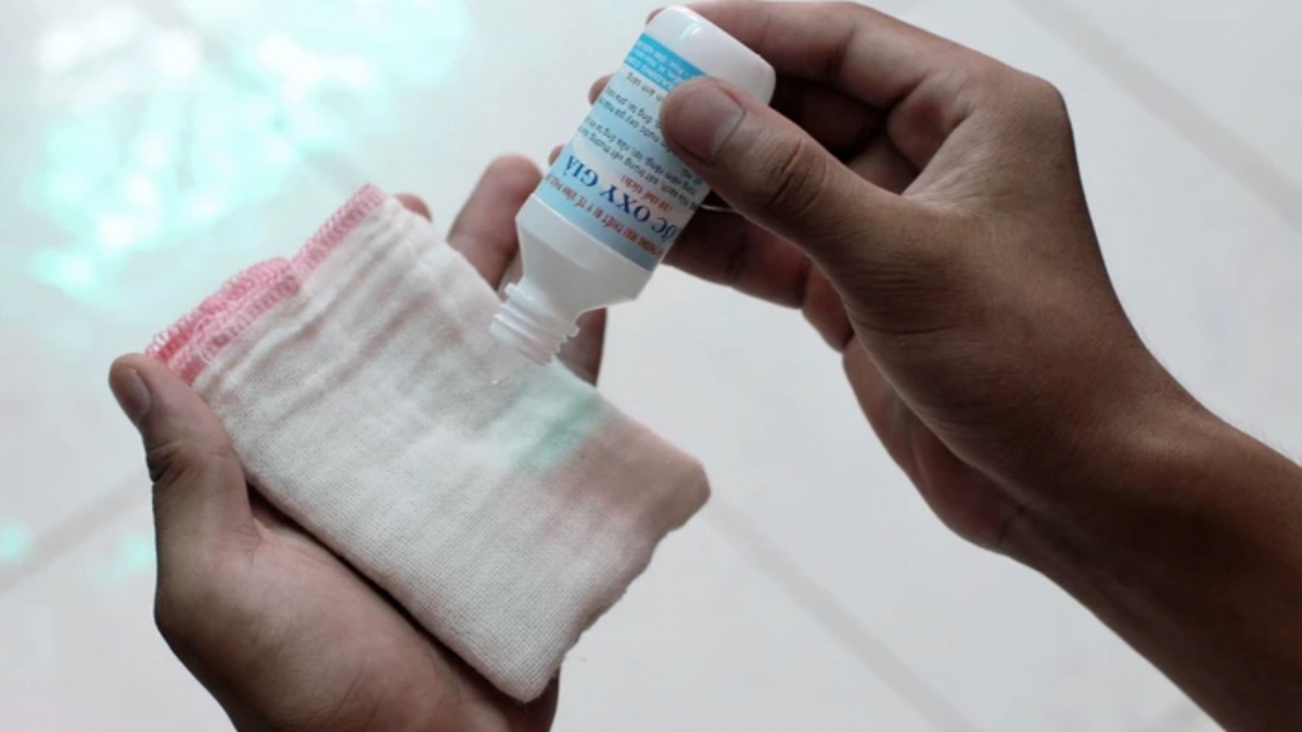 co nen dung oxy gia de sat trung vet thuong thong thuong hinh anh 1