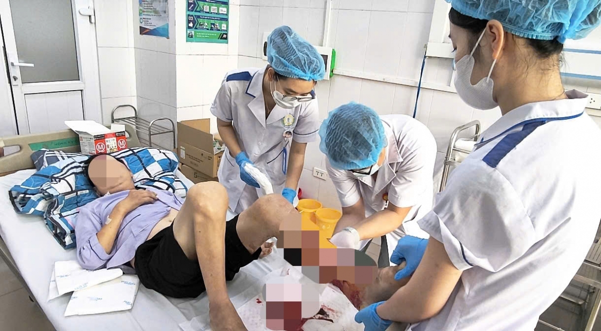 bien chung hoai tu nguy kich sai lam trong xu ly vet thuong tai nha hinh anh 1