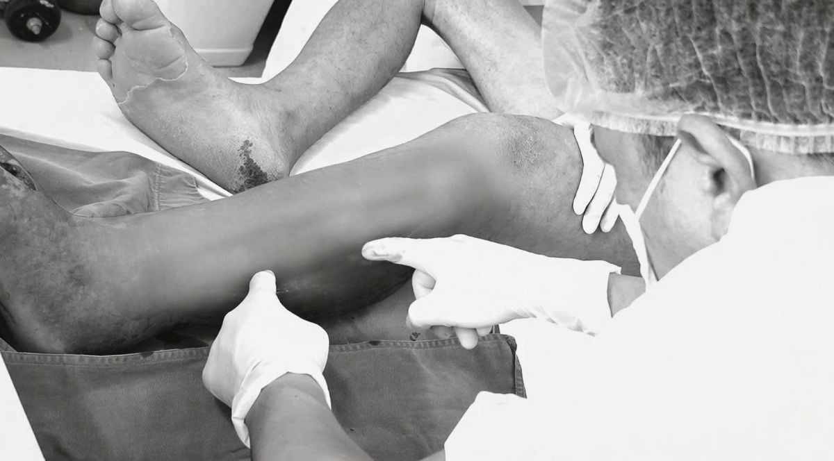 bien chung hoai tu nguy kich sai lam trong xu ly vet thuong tai nha hinh anh 2