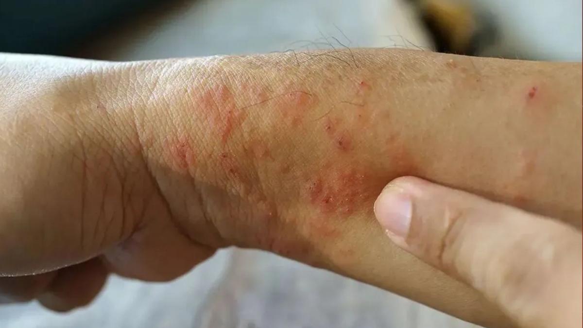 canh giac voi sot dat khi mam benh an trong bun dat va nuoc tu dong hinh anh 2