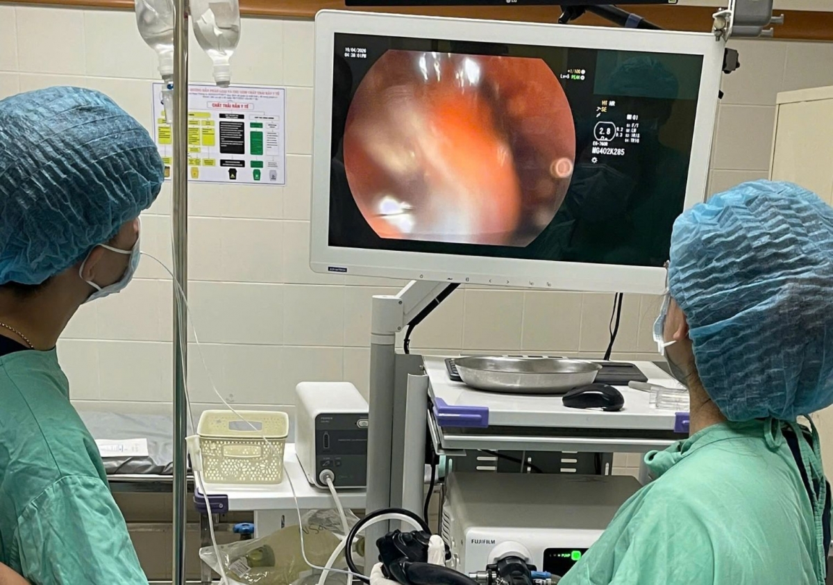 cuu benh nhan nuot cung luc 3 ban chai danh rang dai gan 20cm hinh anh 1