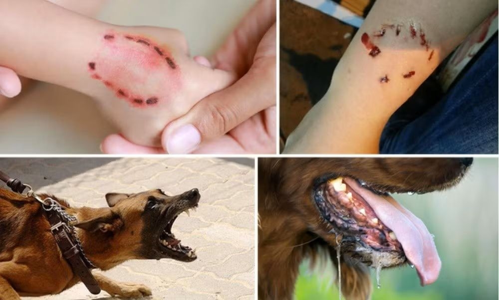 ho chi minh city issues rabies alert amid three deaths picture 1