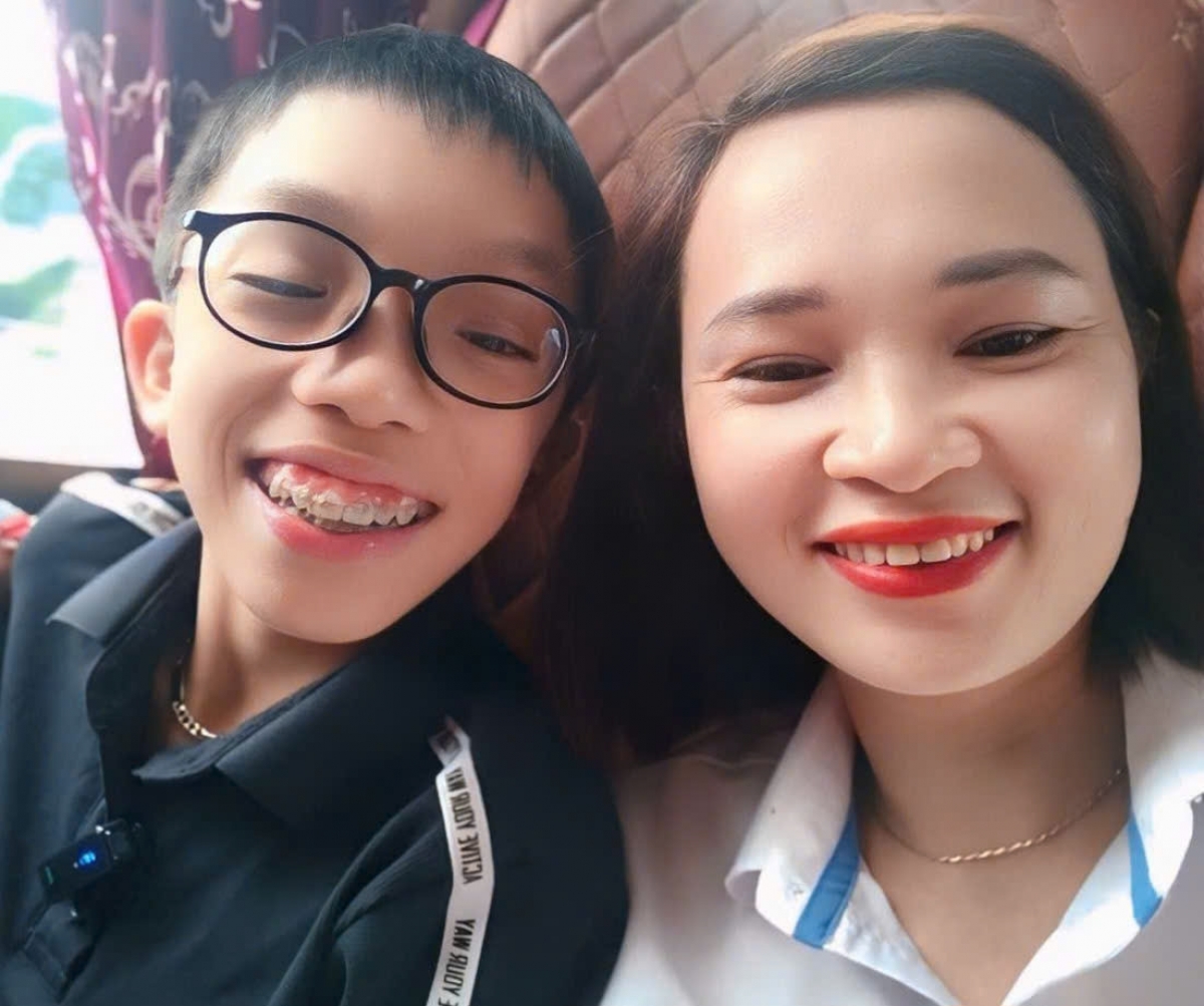 tre thap be, phat hien som va dieu tri dung huong hinh anh 1