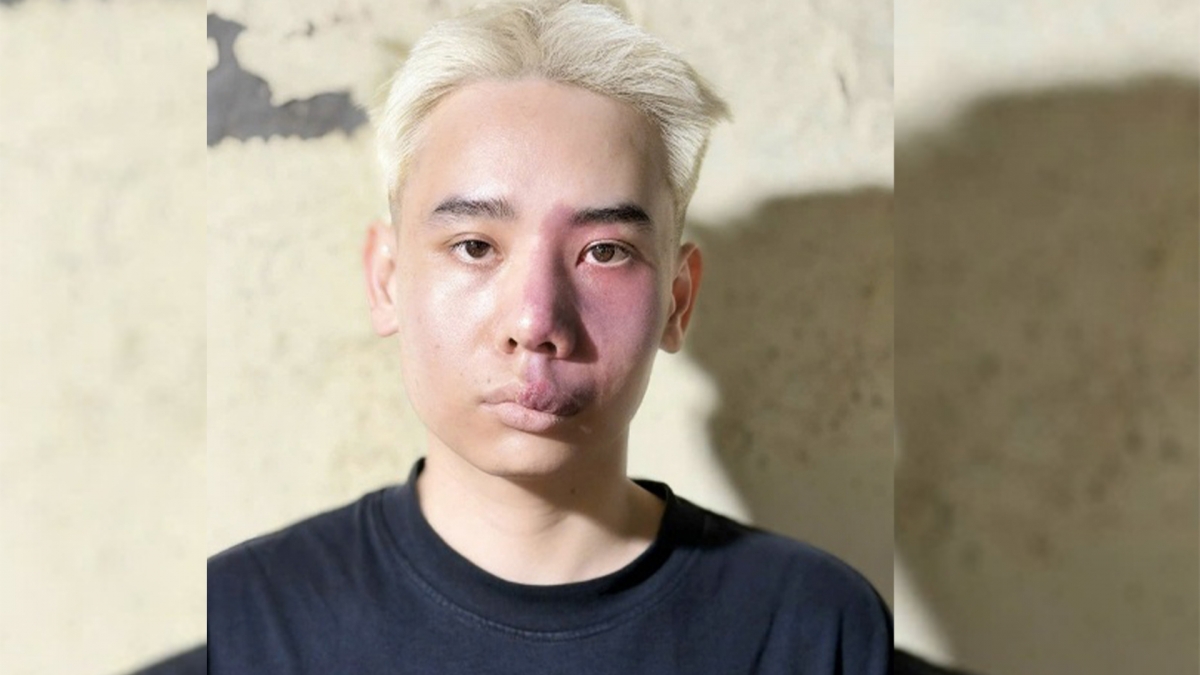 trom xe sh cua ban cung phong roi rao ban tren mang xa hoi hinh anh 1