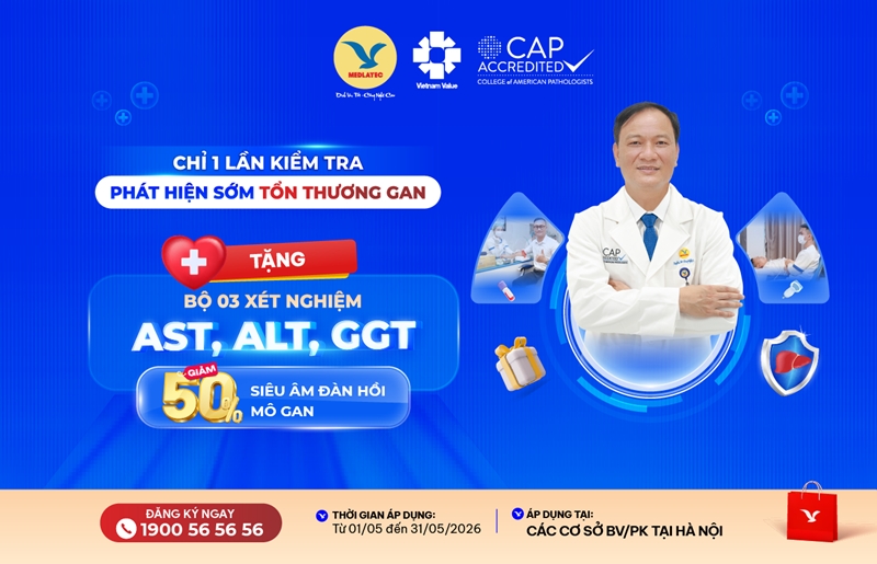 phat hien mac viem gan b man tinh va xo hoa gan khi kiem tra suc khoe dinh ky hinh anh 3