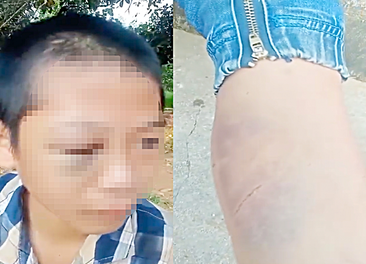 cong an vao cuoc xac minh vu be trai lop 6 o nghe an nghi bi bao hanh hinh anh 1
