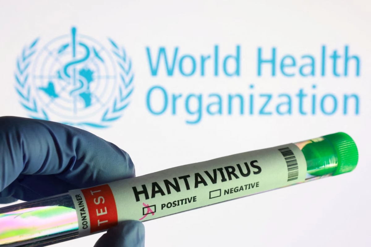 cac nuoc tang cuong cach ly, gioi khoa hoc tim loi giai vaccine cho virus hanta hinh anh 1