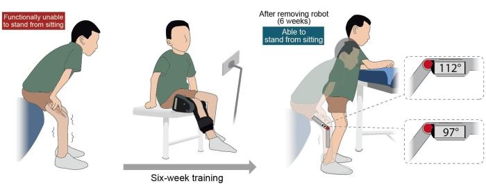trung quoc phat trien robot deo ho tro tre mac teo co tuy song phuc hoi van dong hinh anh 1