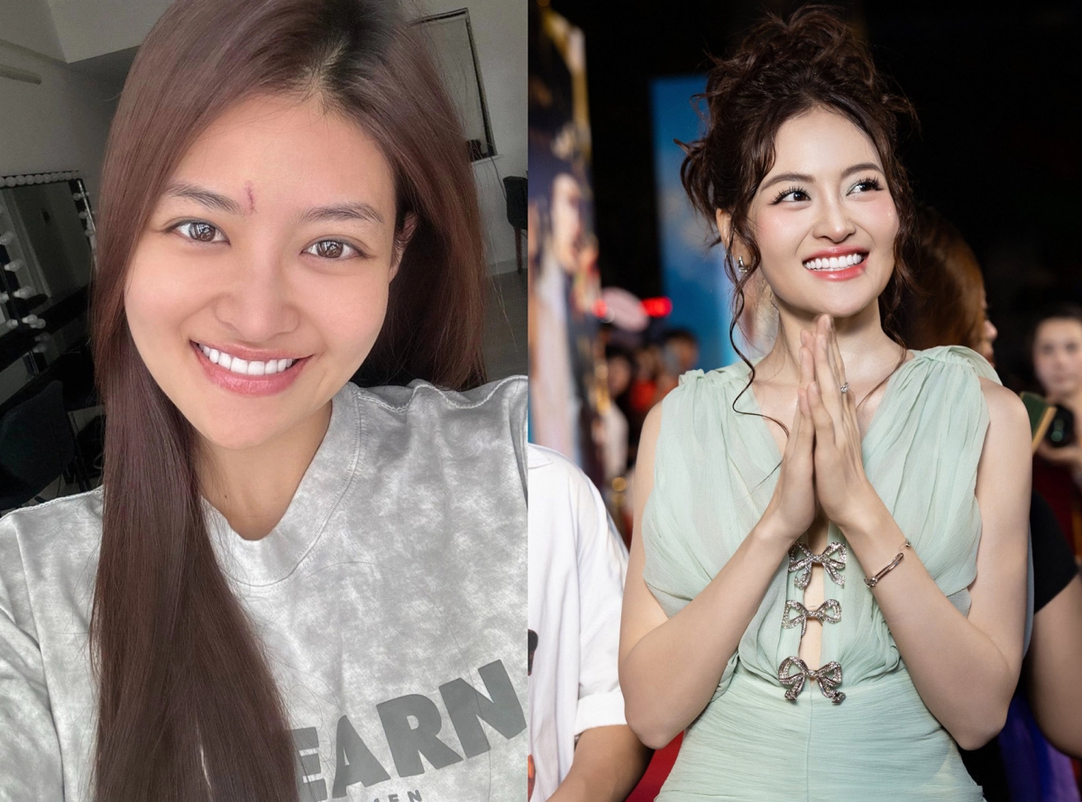 sao viet 5 5 dien vien thuy anh thang kien trong vu bi doi boi thuong 20 ty dong hinh anh 1