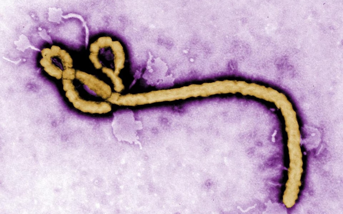 who dich ebola tai congo, uganda la tinh trang khan cap ve y te toan cau hinh anh 1