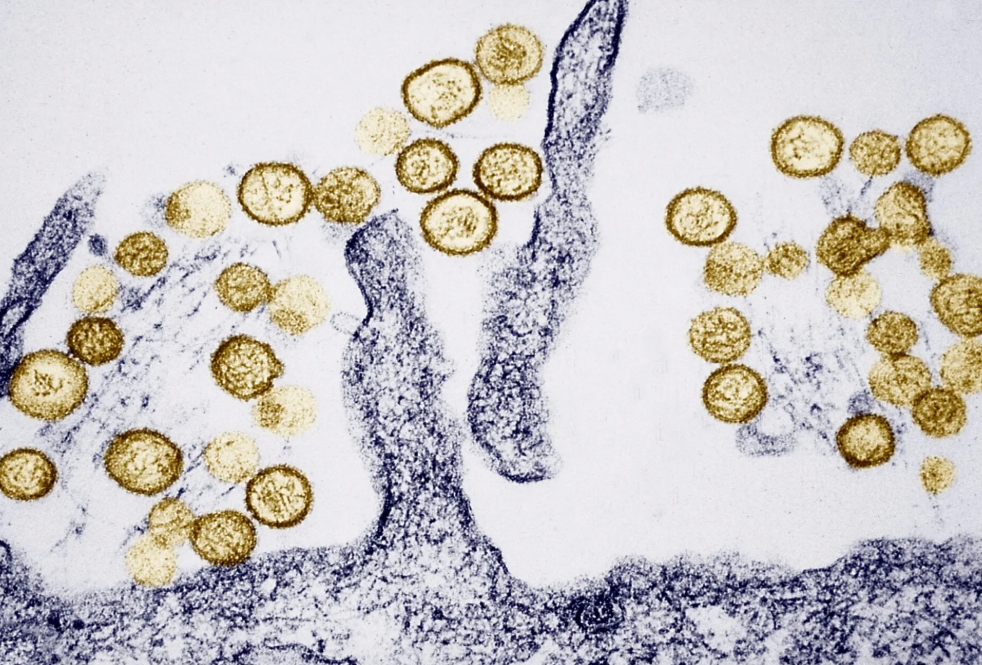 Virus Hanta bùng phát trên tàu du lịch xuyên Đại Tây Dương