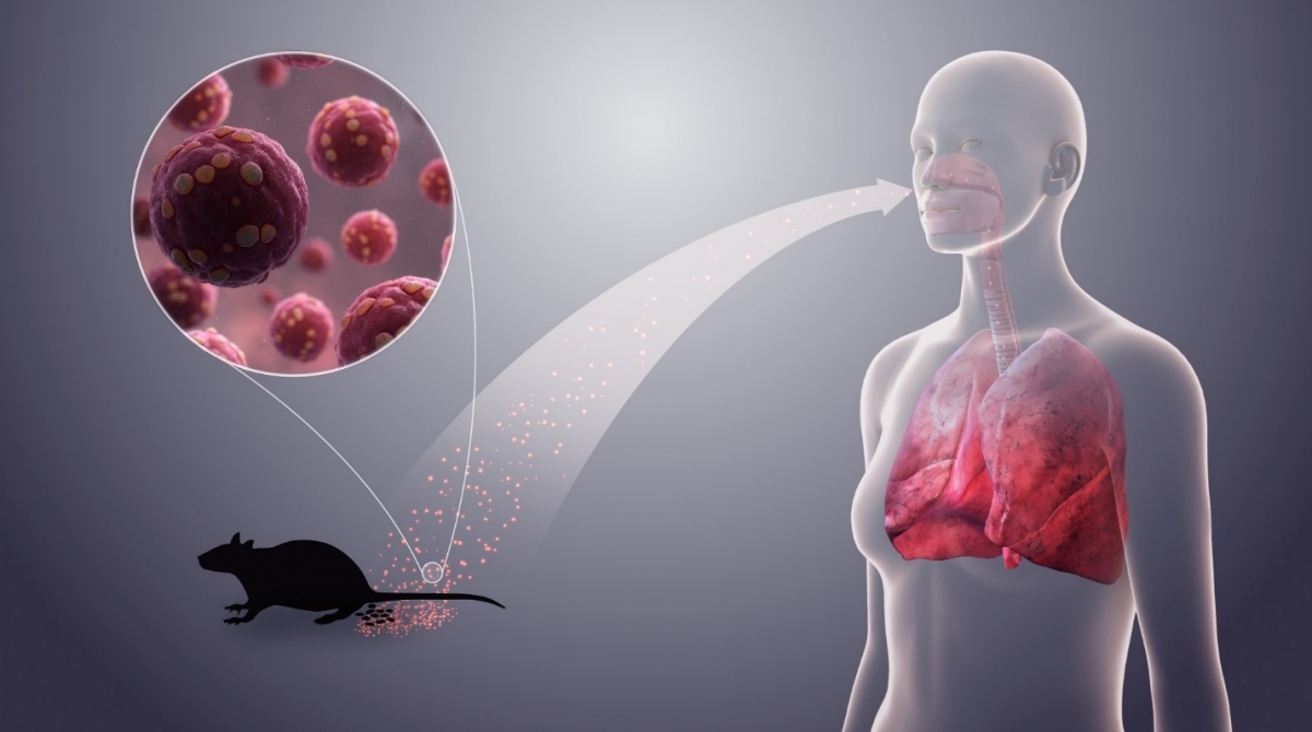 trieu chung nhiem virus hanta de nham voi cac benh khac, lam gi de phong ngua hinh anh 1