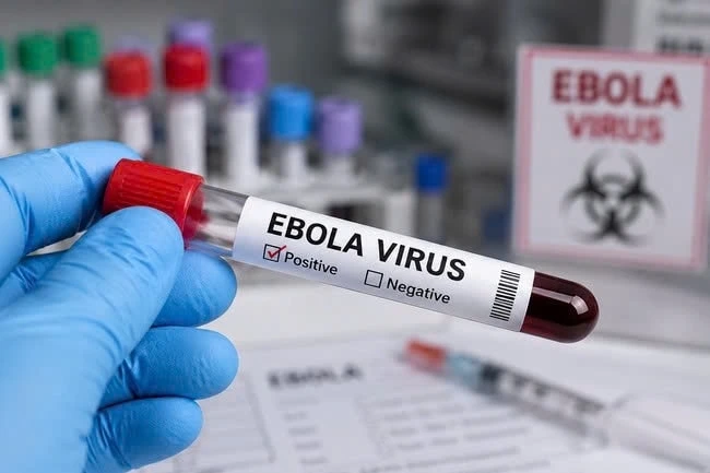  2 phut vang khi kham benh co the quyet dinh viec phat hien ca nghi ebola hinh anh 1