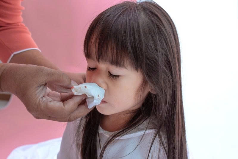 Trẻ hay chảy máu cam: Ăn gì để cải thiện nhanh và an toàn?