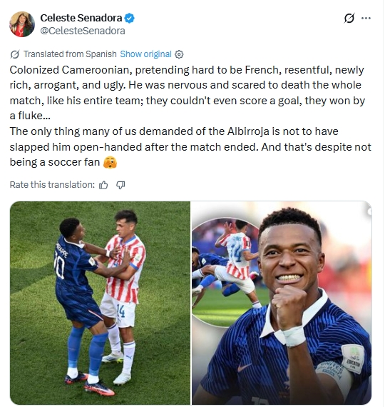 mbappe bi nu nghi si paraguay phan biet chung toc hinh anh 2