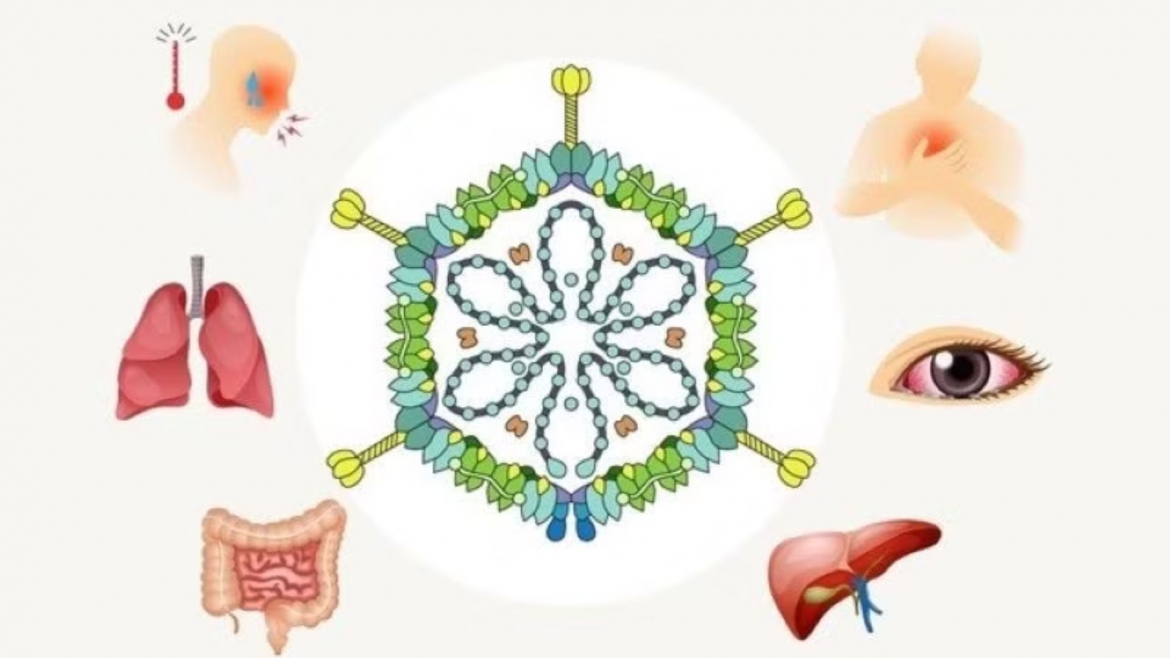 4 tre cung lop hoc boi mac adenovirus, nguy co lay lan tai be boi cong dong hinh anh 1
