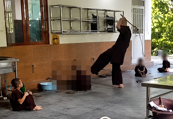 vu 5 chu tieu o chua bau bi danh gay thuong tich bo y te vao cuoc hinh anh 1