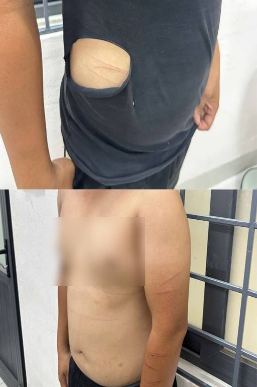 xu phat thanh nien bia chuyen bi cuop 40 trieu dong, tu dung hien truong gia hinh anh 1