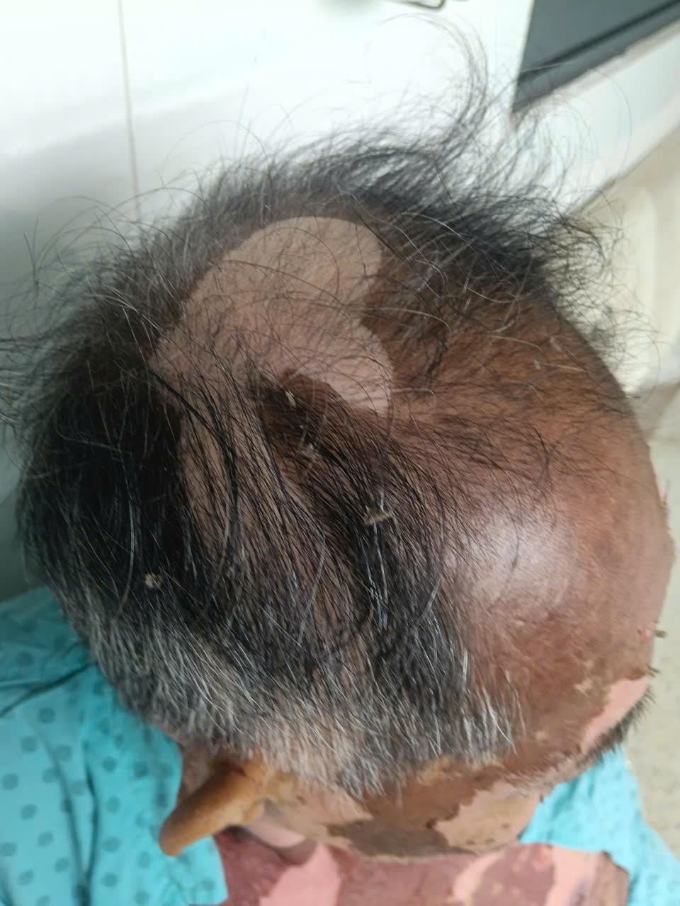 tu dung thuoc nho mat, nguoi dan ong bi hoai tu da nghiem trong hinh anh 2