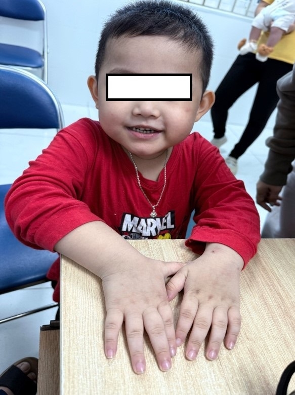 be 4 tuoi tim tai ca khi ngu va thuc, phat hien benh hiem hinh anh 2