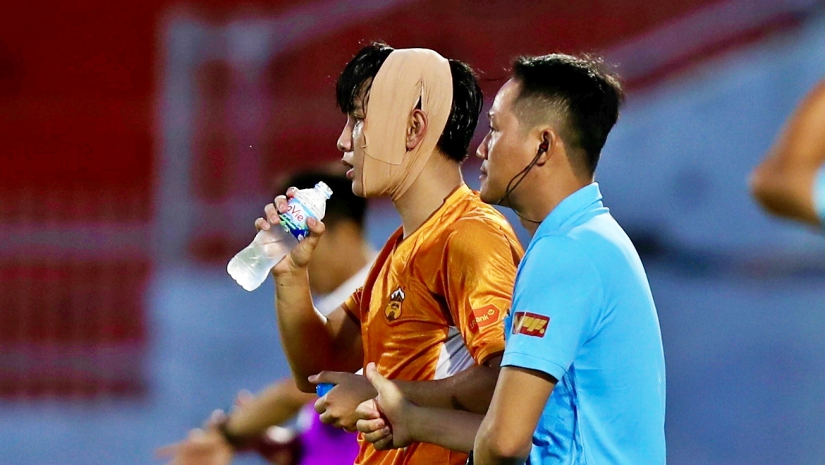  than dong cua hagl len tieng ve tuong lai hinh anh 1