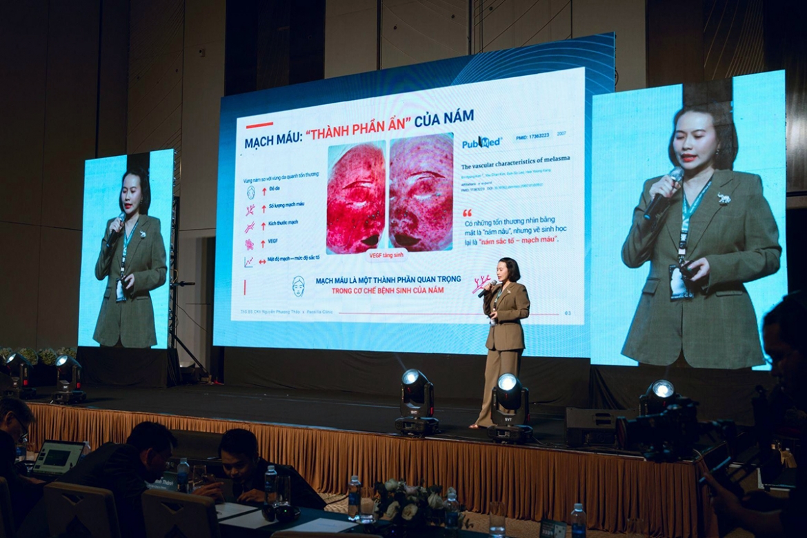 dr nguyen phuong thao what should patients know about laser treatment for melasma picture 2
