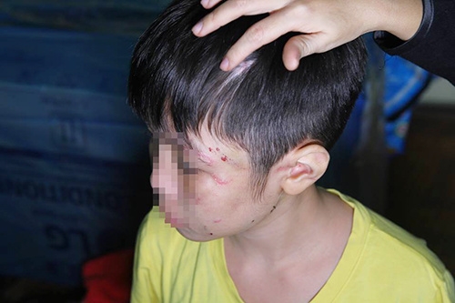 Hanoi man arrested for battering starving 10-year-old son