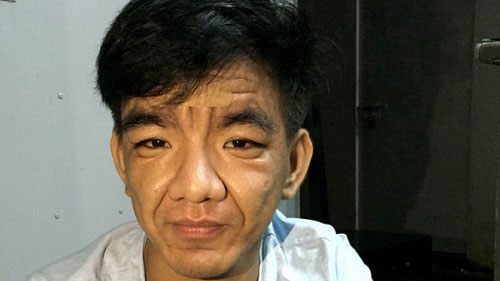 Vietnam soldier grows 30 years older in 3 years