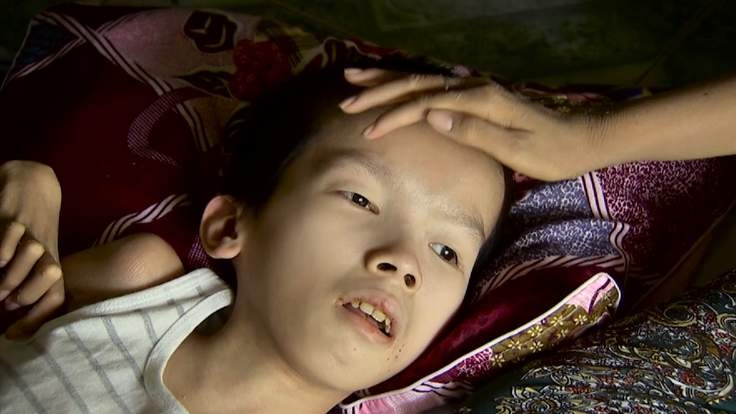 Obama urged to meet Agent Orange victims