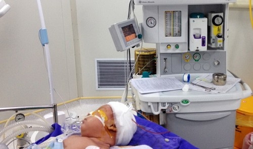 Vietnamese doctors save infant after head sliced by falling knife