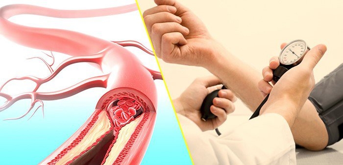 Nạn nhân của “kẻ giết người thầm lặng” đang ngày càng trẻ hóa