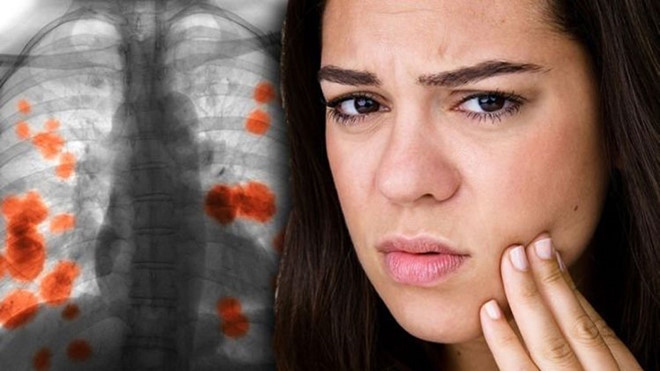 Thấy những dấu hiệu này trên mặt, nên đi khám ung thư phổi ngay!