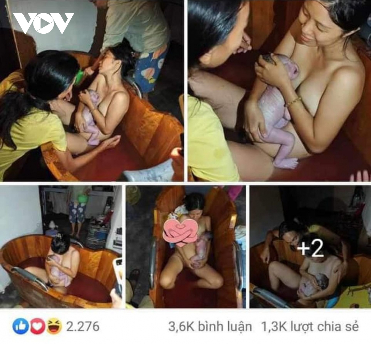 Cảnh báo sinh con “thuận tự nhiên” tại nhà: Nguy hiểm, có thể tai biến sản khoa