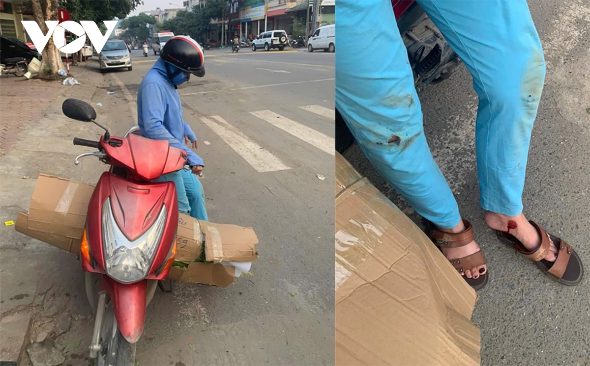 tranh cai quanh go giam toc moi o lao cai nhin tu thuc tien hinh anh 1