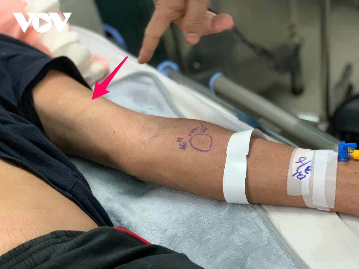 sốt xuất huyết diễn biến bất thường, người béo phì đối mặt nguy cơ trở nặng hình ảnh 3 sot xuat huyet dien bien bat thuong, nguoi beo phi doi mat nguy co tro nang hinh anh 3