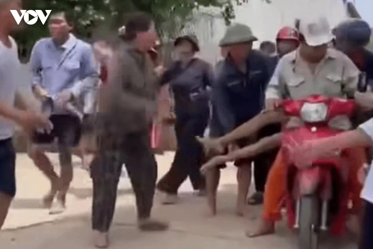 bi ong dot, nguoi dan ong tu vong tren duong di cap cuu hinh anh 1