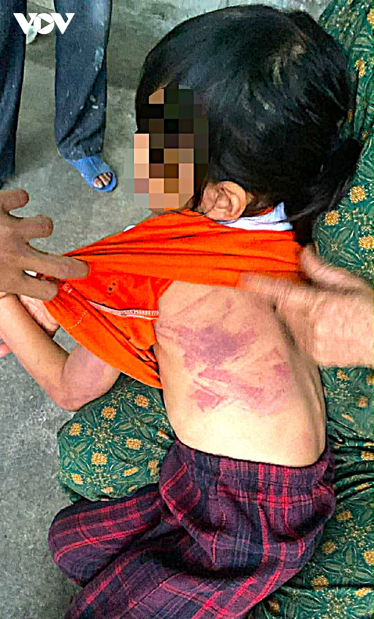 be gai lop 2 o ha tinh bi ban cung lop dung thuoc danh bam tim nguoi hinh anh 1