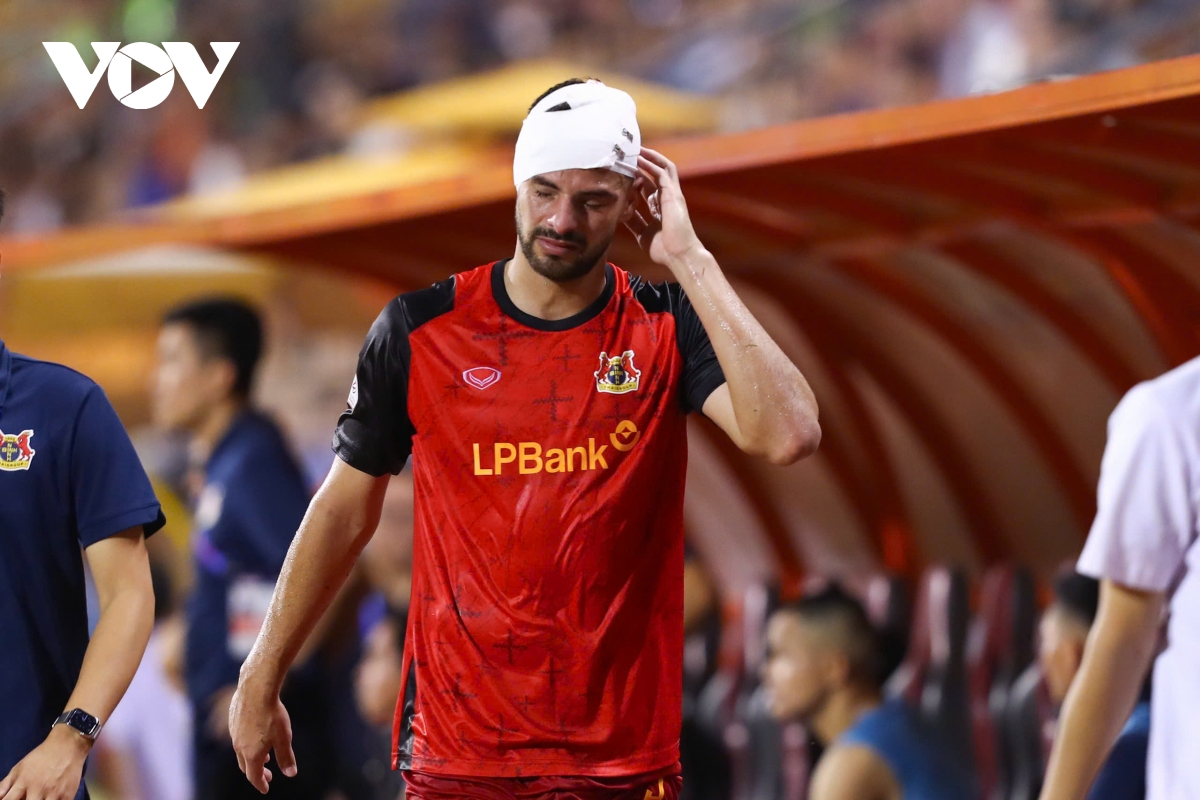 ngoai binh ninh binh chan thuong nang o dau, phai nhap vien cap cuu hinh anh 4