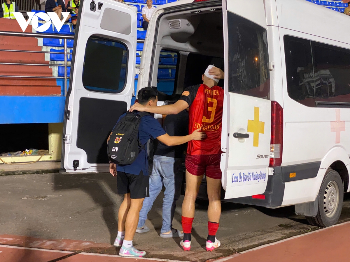 ngoai binh ninh binh chan thuong nang o dau, phai nhap vien cap cuu hinh anh 5