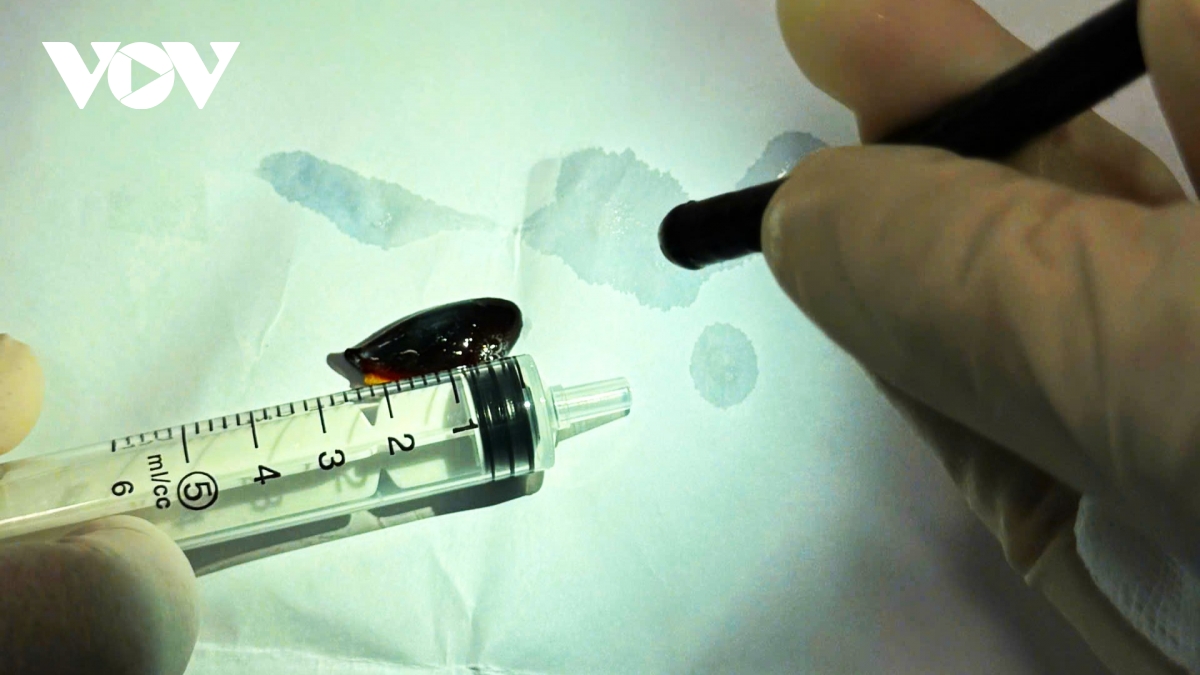 hy huu hat sapoche mac trong phoi cu ba u80 suot 2 thang hinh anh 1