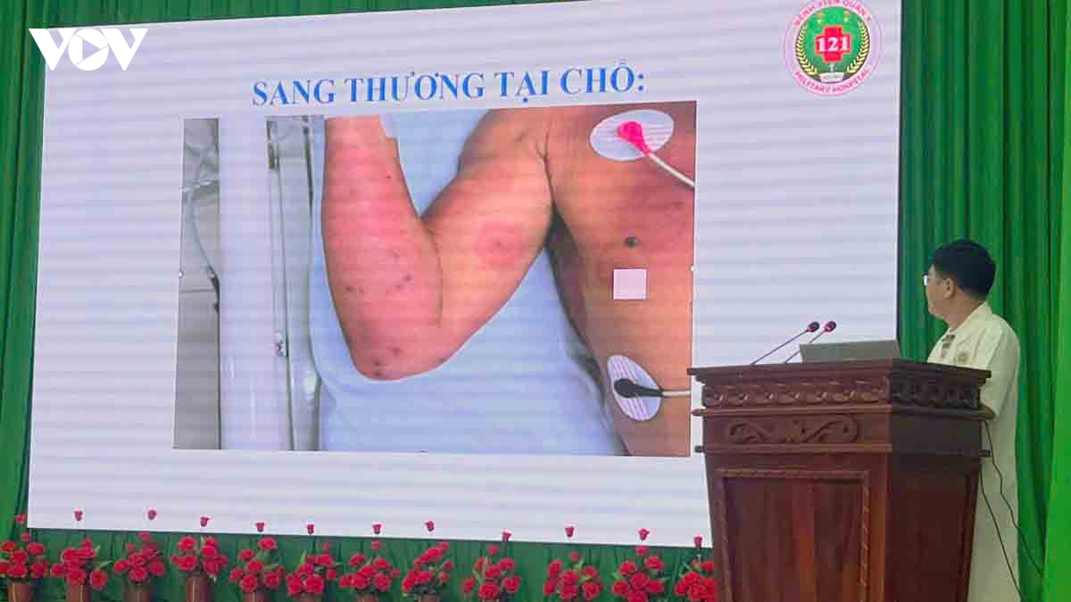 Cứu sống bệnh nhân bị ong vò vẽ đốt 150 vết