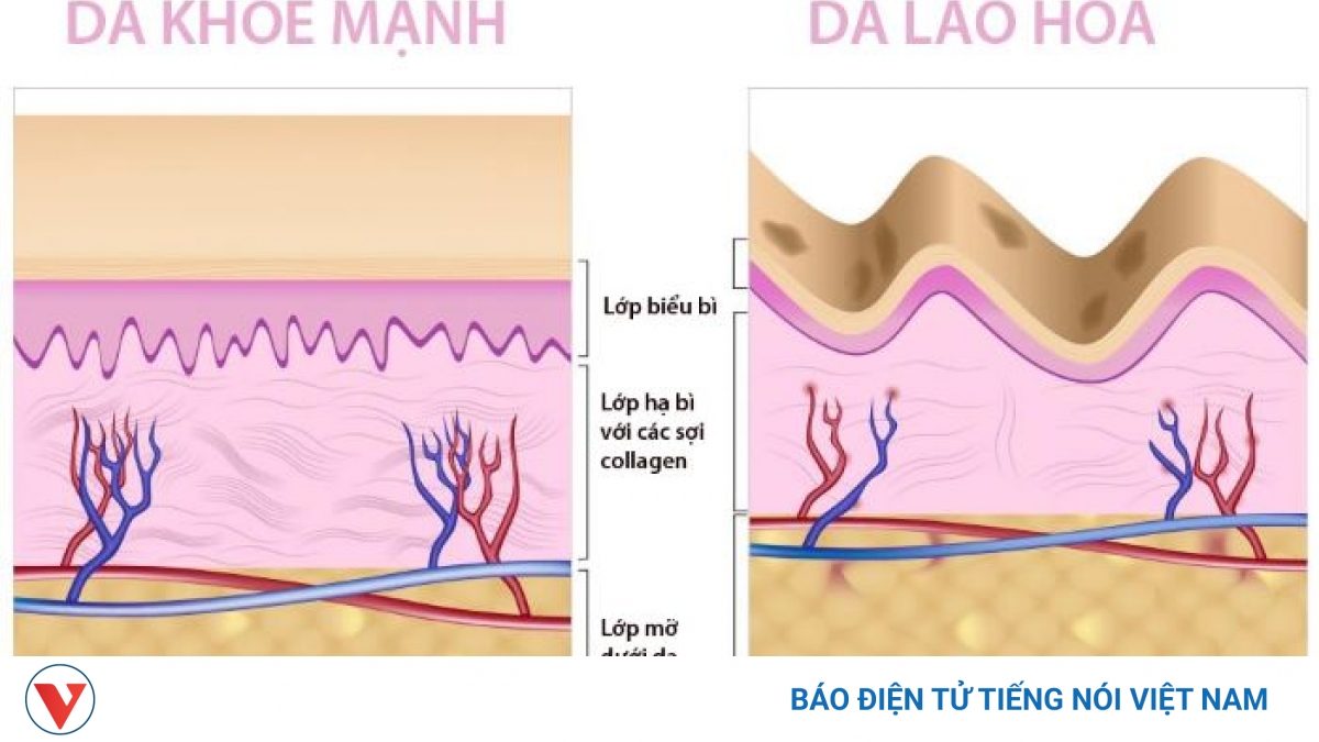 Biện pháp dễ thực hiện giúp làm chậm lão hóa da - Vimarsana News