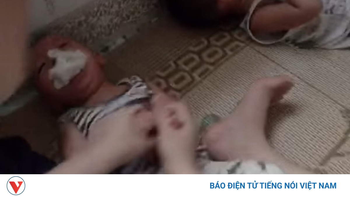 Bộ GD-ĐT yêu cầu xác minh vụ cháu bé bị nhét giẻ vào miệng - Vimarsana News
