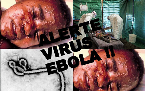 ebola_tzgv.jpg