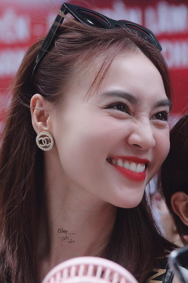 chuyen showbiz: viet anh bi che nu tinh sau khi phau thuat qua da hinh 7