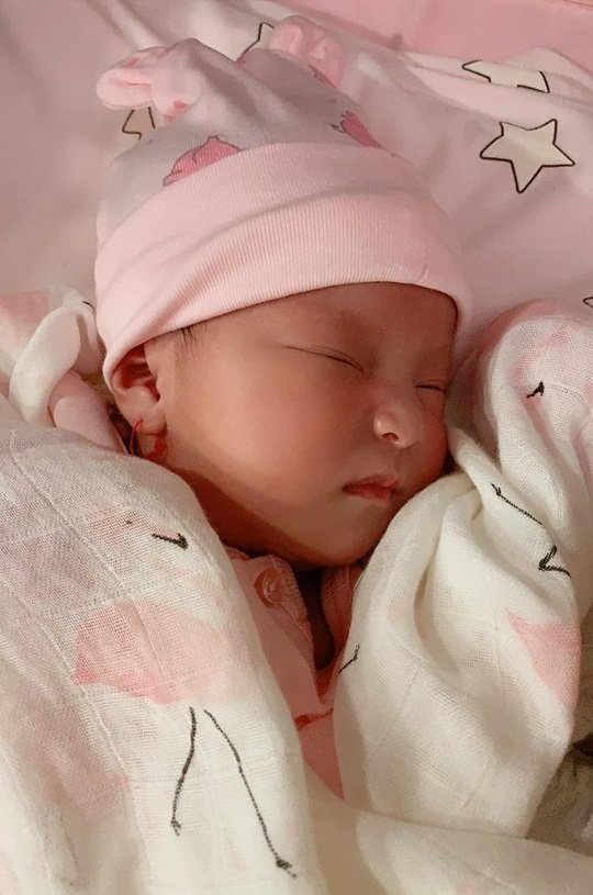 chuyen showbiz: viet anh bi che nu tinh sau khi phau thuat qua da hinh 8